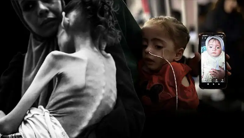 Küçük Meryem'in Açlıkla Savaşında Kayıp: 25 Kilodan 10 Kiloya Düşüşü