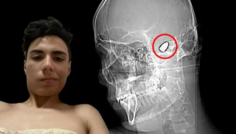 Geçmişi ile Yüzleşen Genç: Kafasında Patlayan Düşünceler