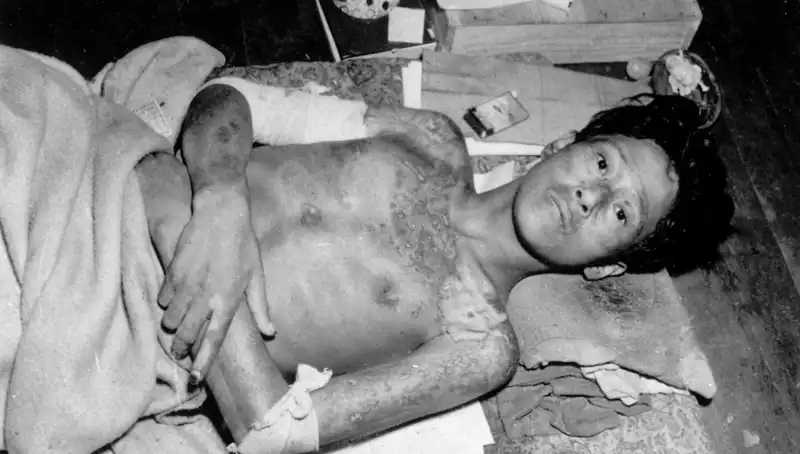 80 Yıl Sonra Nagasaki’den Gelen Çarpıcı Uyarı: Nükleer Felaket Tehdidi Artıyor