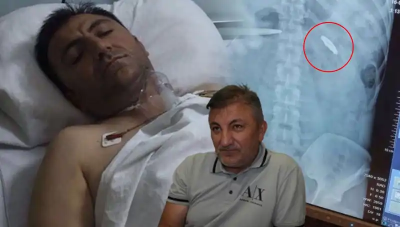 15 Temmuz’un İzleri: Vücudunda Kurşunla Taşıyanların Dramı