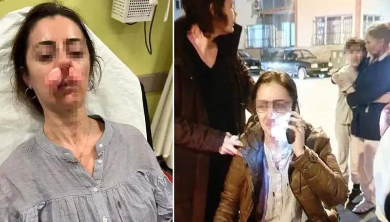 Otomobil Kapısı Silah Sayıldı: Eşinin Sevgilisiyle Yaşanan Şok Olay